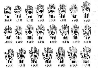 1523241325691689.png blob.png